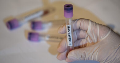 CDC says there are no U.S. hantavirus cases currently, 41 people being monitored CDC says there are no U.S. hantavirus cases currently, 41 people being monitored