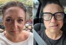 Erica blev biten av fästing – förlamades i ansiktet