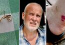 Jon Ragnar fick ett ovanligt bett: ”Intensiv smärta” Jon Ragnar fick ett ovanligt bett: ”Intensiv smärta”