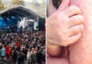 Flera mässlingfall på festival: ”Risk att det finns fler”